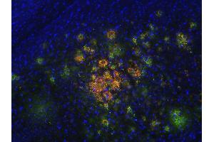 Immunostaining of a PFA fixed brain section from a TTG mouse (dilution 1 : 200; red), counterstained with rabbit anti-abeta (cat.