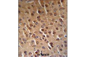 PFTK1 Antibody (N-term P82) (RB18842) IHC analysis in formalin fixed and paraffin embedded human brain tissue followed by peroxidase conjugation of the secondary antibody and DAB staining. (CDK14 anticorps  (N-Term))