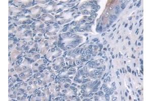 Detection of GLRX in Mouse Esophagus Tissue using Polyclonal Antibody to Glutaredoxin (GLRX)