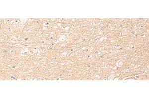 Immunohistochemistry of paraffin-embedded Human brain tissue using ELP1 Polyclonal Antibody at dilution of 1:30(x200) (IKAP/p150 anticorps)