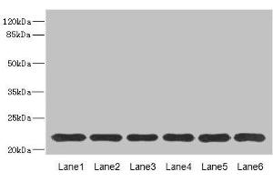 Western blot All lanes: SAR1A antibody at 4. (SAR1A anticorps  (AA 1-198))