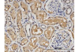 Immunoperoxidase of monoclonal antibody to CCS on formalin-fixed paraffin-embedded human kidney.