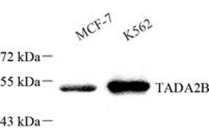 Western blot analysis of TADA2B (ABIN7075957) at dilution of 1: 1000,Lane 1: MCF-7 cell lysate,Lane 2: K562 cell lysate