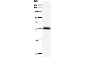Western Blotting (WB) image for anti-Nuclear Receptor Interacting Protein 1 (NRIP1) antibody (ABIN931071) (NRIP1 anticorps)