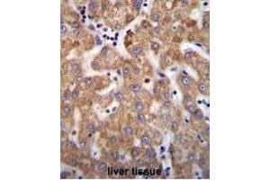 ANKRD58 Antibody (C-term) immunohistochemistry analysis in formalin fixed and paraffin embedded human liver tissue followed by peroxidase conjugation of the secondary antibody and DAB staining. (ANKRD58 anticorps  (C-Term))