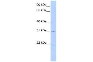 WB Suggested Anti-SLC25A21 Antibody Titration:  0. (SLC25A21 anticorps  (N-Term))