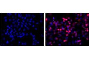 LEFT: untransfected control, RIGHT: anti-His (in red) on His-tagged fusion proteins in HEK293 cells. (His Tag anticorps)