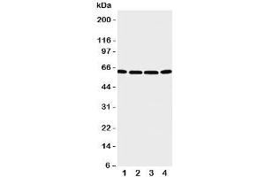 Western blot testing of P2X6 antibody and Lane 1:  U87;  2: 22RV1;  3: Jurkat;  4: HT1080 cell lysate. (P2RX6 anticorps  (C-Term))