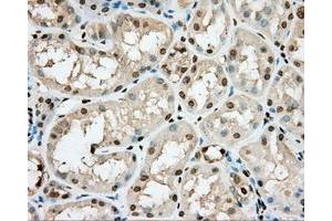 Immunohistochemical staining of paraffin-embedded pancreas tissue using anti-PRKG1 mouse monoclonal antibody. (PRKG1 anticorps)