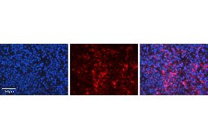 Rabbit Anti-CDK5R1 Antibody Catalog Number: ARP30200_P050 Formalin Fixed Paraffin Embedded Tissue: Human Lymph Node Tissue Observed Staining: Cytoplasm Primary Antibody Concentration: 1:600 Other Working Concentrations: N/A Secondary Antibody: Donkey anti-Rabbit-Cy3 Secondary Antibody Concentration: 1:200 Magnification: 20X Exposure Time: 0.