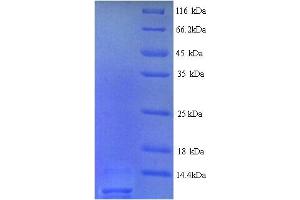 SDS-PAGE (SDS) image for Angiotensin II Receptor, Type 2 (AGTR2) (AA 1-45), (Extracellular) protein (His tag) (ABIN5713204)