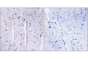 Immunohistochemistry analysis of paraffin-embedded human heart tissue, using AKAP13 Antibody. (AKAP13 anticorps  (AA 721-770))