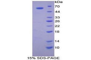SDS-PAGE analysis of Dog Cathepsin K Protein. (Cathepsin K Protein (CTSK))