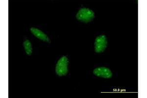 Immunofluorescence of purified MaxPab antibody to EXO1 on HeLa cell.
