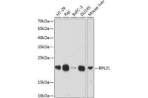 Western blot analysis of extracts of various cell lines, using RPL21 antibody (ABIN7269996) at 1:1000 dilution.