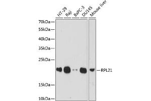Western blot analysis of extracts of various cell lines, using RPL21 antibody (ABIN7269996) at 1:1000 dilution. (RPL21 anticorps  (AA 1-160))