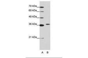 Image no. 1 for anti-Exosome Component 7 (EXOSC7) (AA 71-120) antibody (ABIN202173) (EXOSC7 anticorps  (AA 71-120))