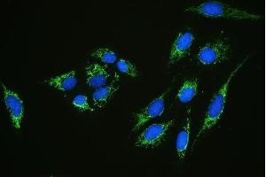 IF analysis of C1QBP using anti-C1QBP antibody (ABIN4886491). (C1QBP anticorps  (AA 190-282))