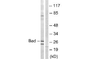 Immunohistochemistry analysis of paraffin-embedded human brain tissue using BAD (Ab-134) antibody. (BAD anticorps)