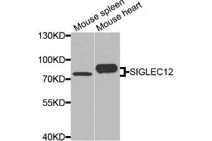 Western blot analysis of extracts of mouse spleen and mouse heart cells, using SIGLEC12 antibody. (SIGLEC12 anticorps)