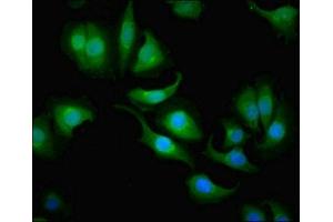 Immunofluorescent analysis of A549 cells using ABIN7146698 at dilution of 1:100 and Alexa Fluor 488-congugated AffiniPure Goat Anti-Rabbit IgG(H+L)