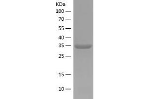 Western Blotting (WB) image for E74-Like Factor 1 (Ets Domain Transcription Factor) (ELF1) (AA 366-412) protein (His tag) (ABIN7122730)