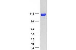 Validation with Western Blot