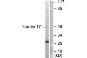 Western blot analysis of extracts from HuvEc cells, using Keratin 17 Antibody.