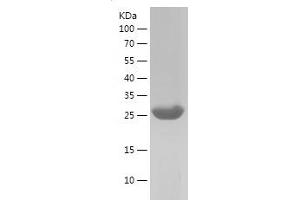 Western Blotting (WB) image for PTK2 Protein tyrosine Kinase 2 (PTK2) (AA 845-1052) protein (His tag) (ABIN7124708)