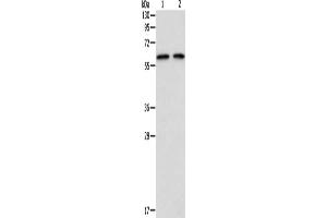 Gel: 8 % SDS-PAGE, Lysate: 40 μg, Lane 1-2: 293T cells, hela cells, Primary antibody: ABIN7128229(ADAM2 Antibody) at dilution 1/300, Secondary antibody: Goat anti rabbit IgG at 1/8000 dilution, Exposure time: 15 seconds (ADAM2 anticorps)