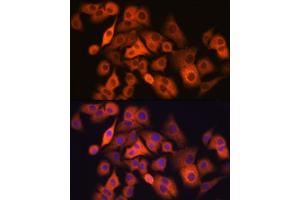 Immunofluorescence analysis of  cells using  Rabbit mAb (ABIN7265531) at dilution of 1:100 (40x lens).