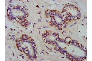 IHC image of ABIN7143526 diluted at 1:300 and staining in paraffin-embedded human breast cancer performed on a Leica BondTM system. (ARFRP1 anticorps  (AA 1-201))