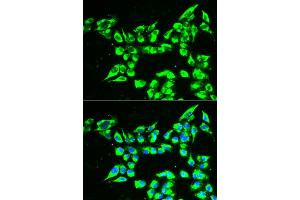 Immunofluorescence analysis of A549 cells using KLK10 antibody (ABIN6290548).