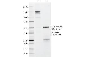 SDS-PAGE Analysis Purified Glycophorin A Mouse Monoclonal Antibody (GYPA/280). (CD235a/GYPA anticorps)
