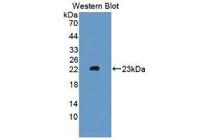 Detection of Recombinant MTMR9, Mouse using Polyclonal Antibody to Myotubularin Related Protein 9 (MTMR9) (MTMR9 anticorps  (AA 1-167))