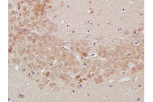 Paraformaldehyde-fixed, paraffin embedded Mouse Brain Antigen retrieval by boiling in sodium citrate buffer (pH6.