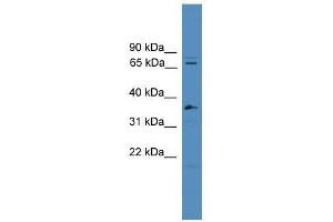 Western Blot showing SF4 antibody used at a concentration of 1-2 ug/ml to detect its target protein. (Splicing Factor 4 anticorps  (C-Term))