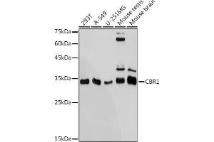 Western blot analysis of extracts of various cell lines, using CBR1 antibody (ABIN7266076) at 1:1000 dilution. (CBR1 anticorps)