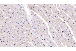 Detection of SEMA5B in Human Cardiac Muscle Tissue using Polyclonal Antibody to Semaphorin 5B (SEMA5B)