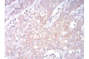 Immunohistochemistry (IHC) image for anti-Low Density Lipoprotein Receptor-Related Protein 1 (LRP1) (AA 20-155) antibody (ABIN5897030) (LRP1 anticorps  (AA 20-155))