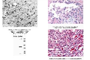 Image no. 6 for anti-8-Oxoguanine DNA Glycosylase (OGG1) (AA 1-100), (N-Term) antibody (ABIN363384)
