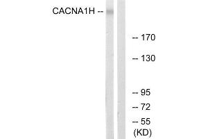 Western Blotting (WB) image for anti-Calcium Channel, Voltage-Dependent, T Type, alpha 1H Subunit (CACNA1H) (Internal Region) antibody (ABIN1852390) (CACNA1H anticorps  (Internal Region))