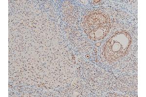 ABIN6267443 at 1/100 staining rat ovarian tissue sections by IHC-P.