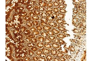 ABIN6255339 and ABIN6267494 at 1/100 staining Rat colon tissue by IHC-P.