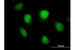 Immunofluorescence of purified MaxPab antibody to FHL1 on HeLa cell. (FHL1 anticorps  (AA 1-280))