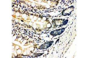 IHC-P: NFKB2 antibody testing of rat intestine tissue (NFKB2 anticorps  (N-Term))