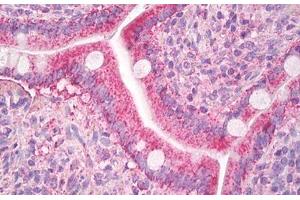 Image no. 1 for anti-Chemokine (C-C Motif) Ligand 8 (CCL8) (AA 24-99) antibody (ABIN1499347)