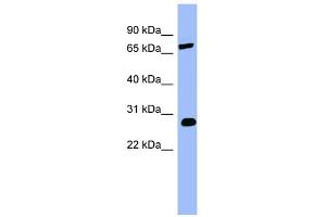 WB Suggested Anti-COMT Antibody Titration:  0. (COMT anticorps  (Middle Region))
