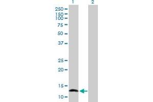 Western Blot analysis of NFATC2IP expression in transfected 293T cell line by NFATC2IP MaxPab polyclonal antibody.
