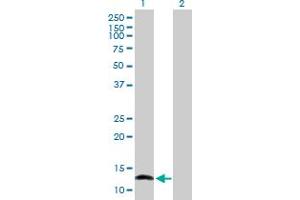 Western Blot analysis of NFATC2IP expression in transfected 293T cell line by NFATC2IP MaxPab polyclonal antibody. (NFATC2IP anticorps  (AA 1-138))